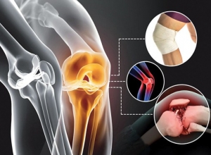 Sai lầm trong cách trị viêm khớp khiến bệnh bạn nặng hơn